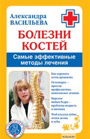 Васильева Александра - Болезни костей. Самые эффективные методы лечения